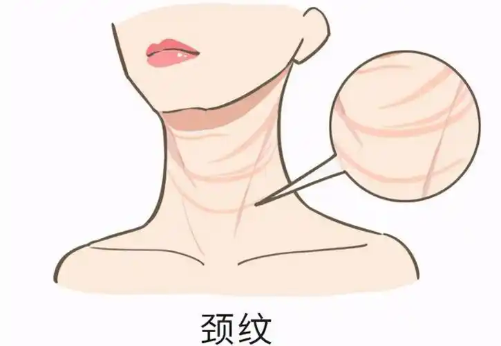 颈纹克星 2025 终极指南:嗨体注射 VS 黄金微针,多伦多美蒂芳华数据对比